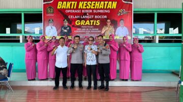 Menjahit Senyum, Menumbuhkan Harapan: Bakti Kesehatan Operasi Bibir Sumbing dan Celah Langit-Langit Gratis Warnai HUT Aceh Tenggara ke-52 dan Hari Bhayangkara ke-80