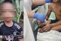 Dokumentasi Foto Korban Penganiayaan Anak