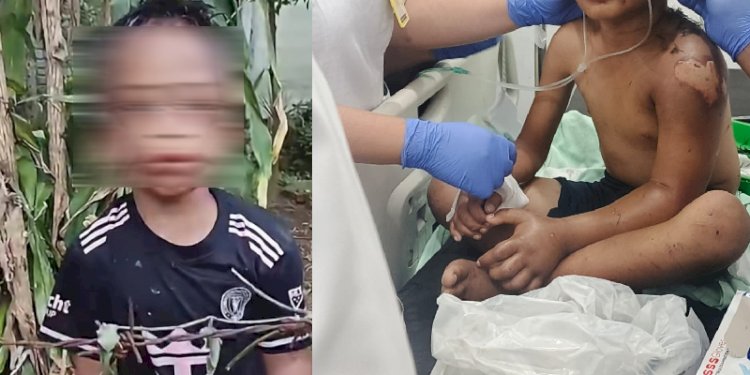 Dokumentasi Foto Korban Penganiayaan Anak 